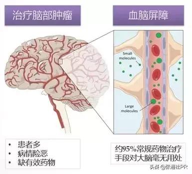 盛山资产完成对ABM Therapeutics投资，助力抗脑癌创新药物研发